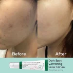 سرم ضد لک اکسیس وای AXIS-Y مدل Dark Spot حجم 50 میلی لیتر - Image 4
