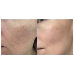 آمپول آبرسان ماداگاسکار سنتلا CENTELLA اسکین 1004 حجم 100 میل - Image 4