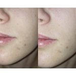 تونر روزانه ویتامین سی کوزارکس حجم 280 میل - Image 3