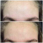 لوسیون مرطوب کننده صورت و بدن پوست خشک CeraVe حجم 473 میل - Image 6