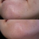 ژل پیلینگ لایه بردار ملایم گودنایت کوزارکس حجم 120 میل - Image 5