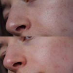 ژل پیلینگ لایه بردار ملایم گودنایت کوزارکس حجم 120 میل - Image 4