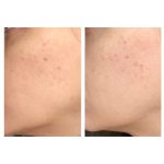 سرم ضد لک و روشن کننده اوردینری Alpha Arbutin 2% + HA - Image 5