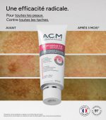 کرم ضدلک و روشن کننده ACM مدل Dépiwhite Advanced - Image 7
